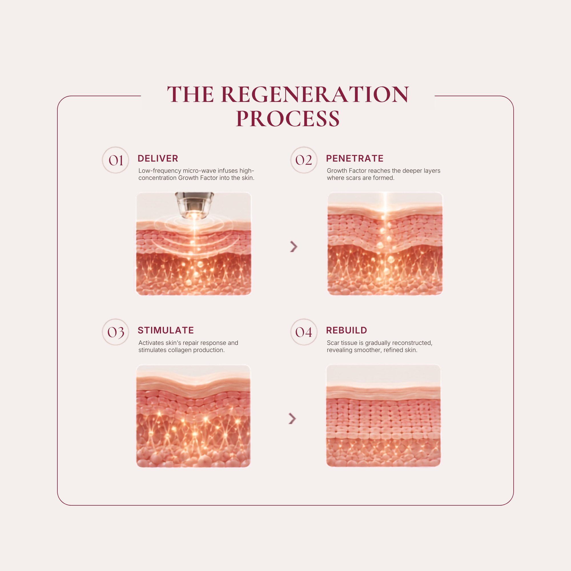 Growth Factor Repair Treatment - Image 5