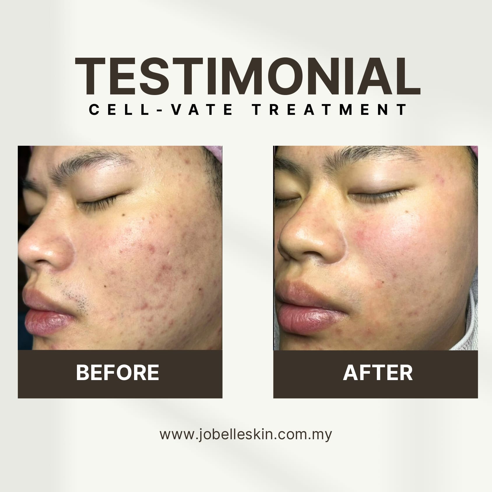 Cell-Vate Treatment - Image 5