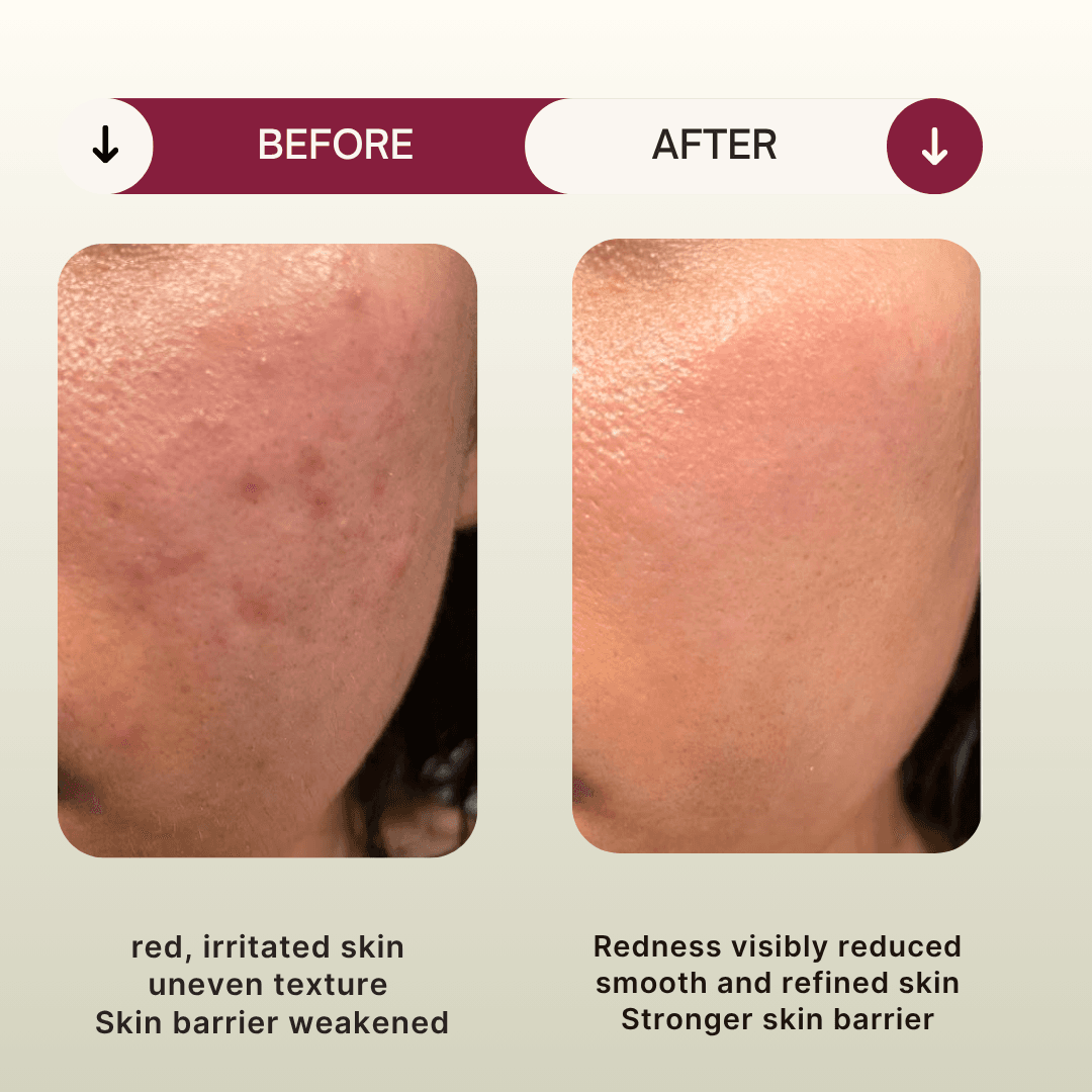 Intensive Recovery Mask - Image 4