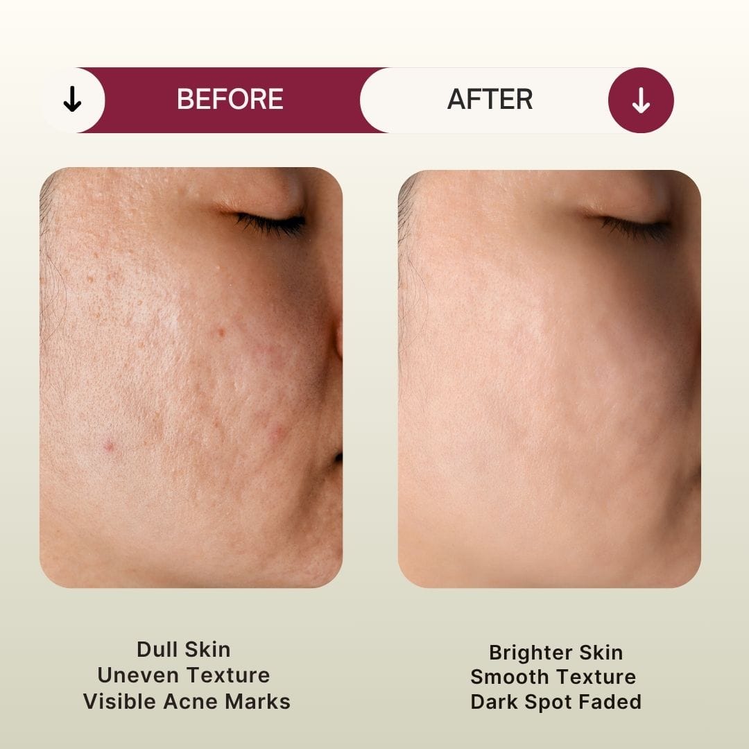 Dewy Mousse Cleanser - Image 5